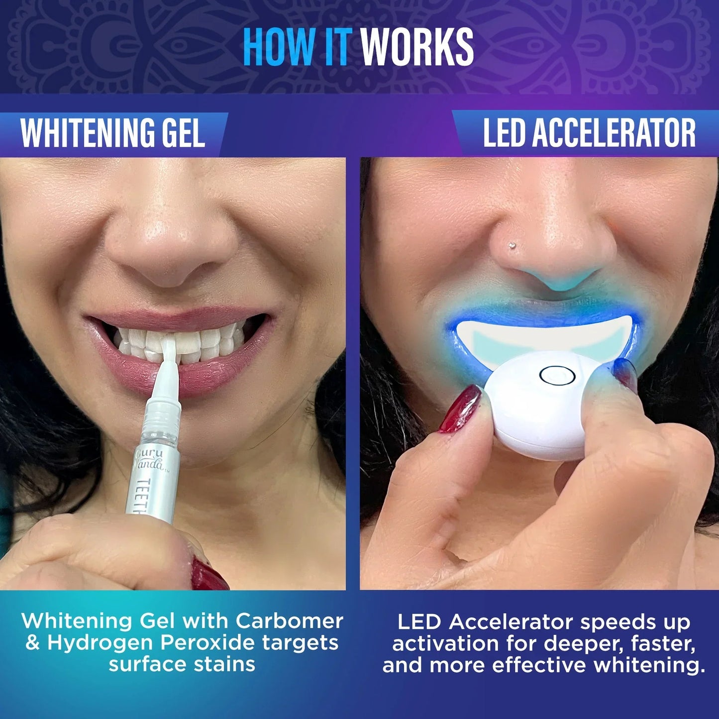 Total Teeth Whitening Smile Makeover Bundle Offer Kit