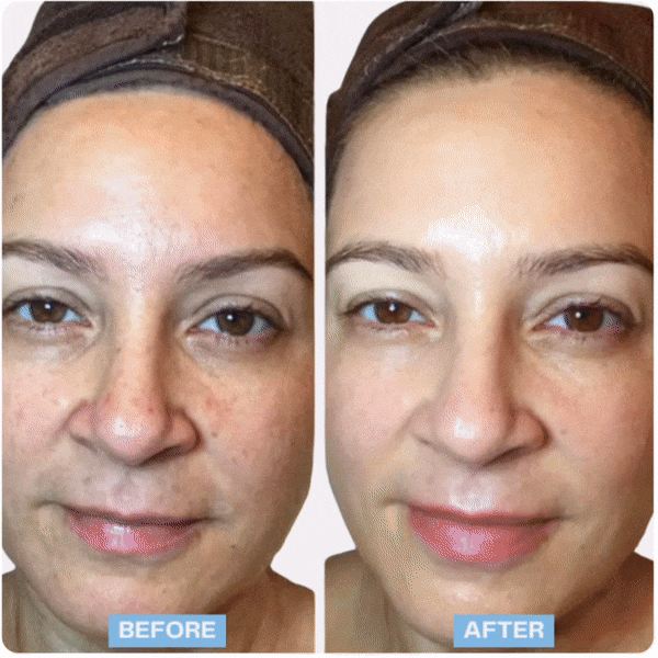 Hey Glam - 7-IN-1 EMS LED FACIAL LIFT SCULPTOR